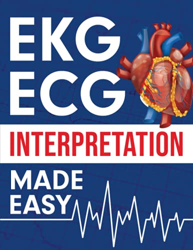 EKG | ECG Interpretation Made Easy: An Illustrated Study Guide...